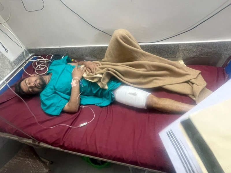 भोपाल में जेल से छूटे बदमाश को सरेराह गोली मारी, अस्पताल में भर्ती