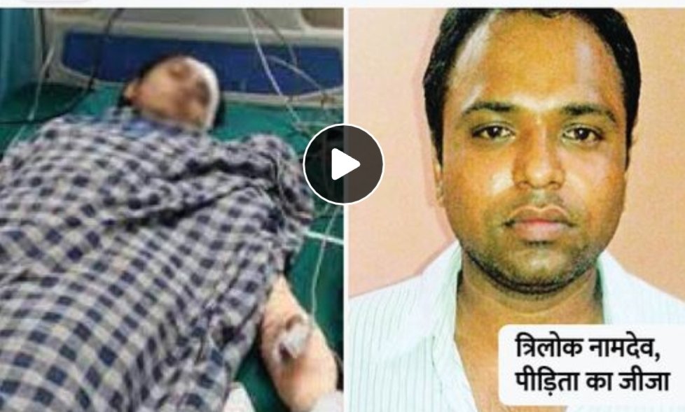 साली पर एसिड फेंकने वाले जीजा को उम्र कैद