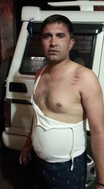पत्रकार पर हुआ जानलेवा हमला, भोपाल में बदमाशों के हौसले बुलंद