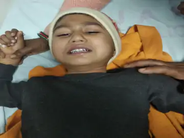 मासूम हुआ डॉग बाइट का शिकार