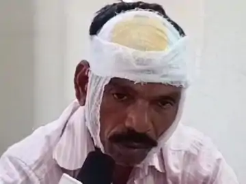 पुलिस पर फिर हमला, एएसआई का सिर फोड़ा