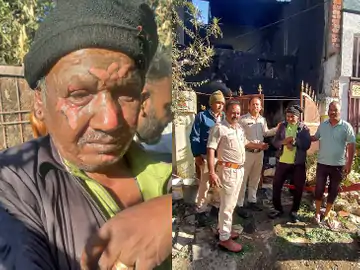 घर में आग, गृहस्थी का सामान बचाने में झुलसे बुजुर्ग