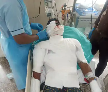 भोपाल में मॉक ड्रिल में डेटोनेटर फटा