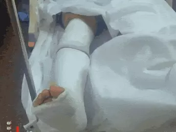 भोपाल में मैनेजर को कार से कुचलने की कोशिश