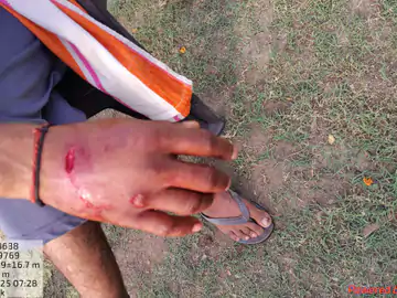 सीहोर में बाघ ने किसान पर किया हमला,घायल