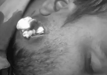 रेड बस के ड्राइवर पर जानलेवा हमला