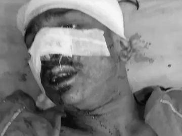 राजधानी में बदमाशों के हौसले बुलंद: नकाबपोशों ने दो युवकों को अधमरा होने तक पीटा