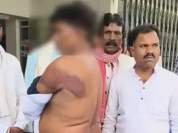 विदिशा: आरक्षक पर युवक को पीटने और अमानवीय कृत्य का आरोप, मामला दर्ज